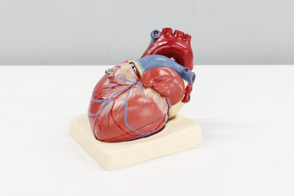 heart,disease,cad